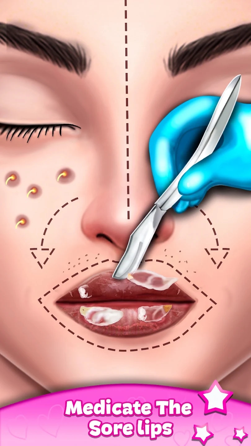 ASMR Makeover Surgery Games apk Download for Android  1.0.19 screenshot 1